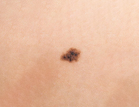 Moles