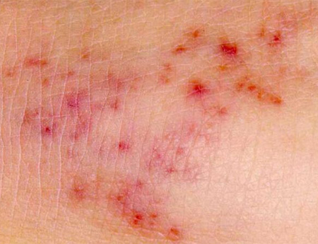 Red spots