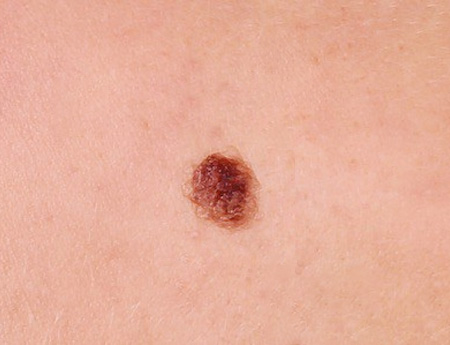 Moles