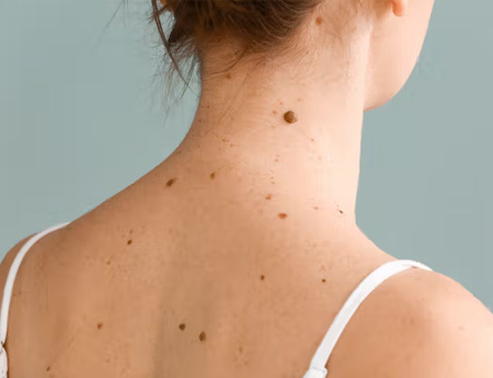 Red Spots